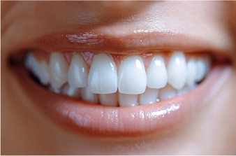 A close-up of a persons mouth smiling, showing straight, white teeth and smooth lips.