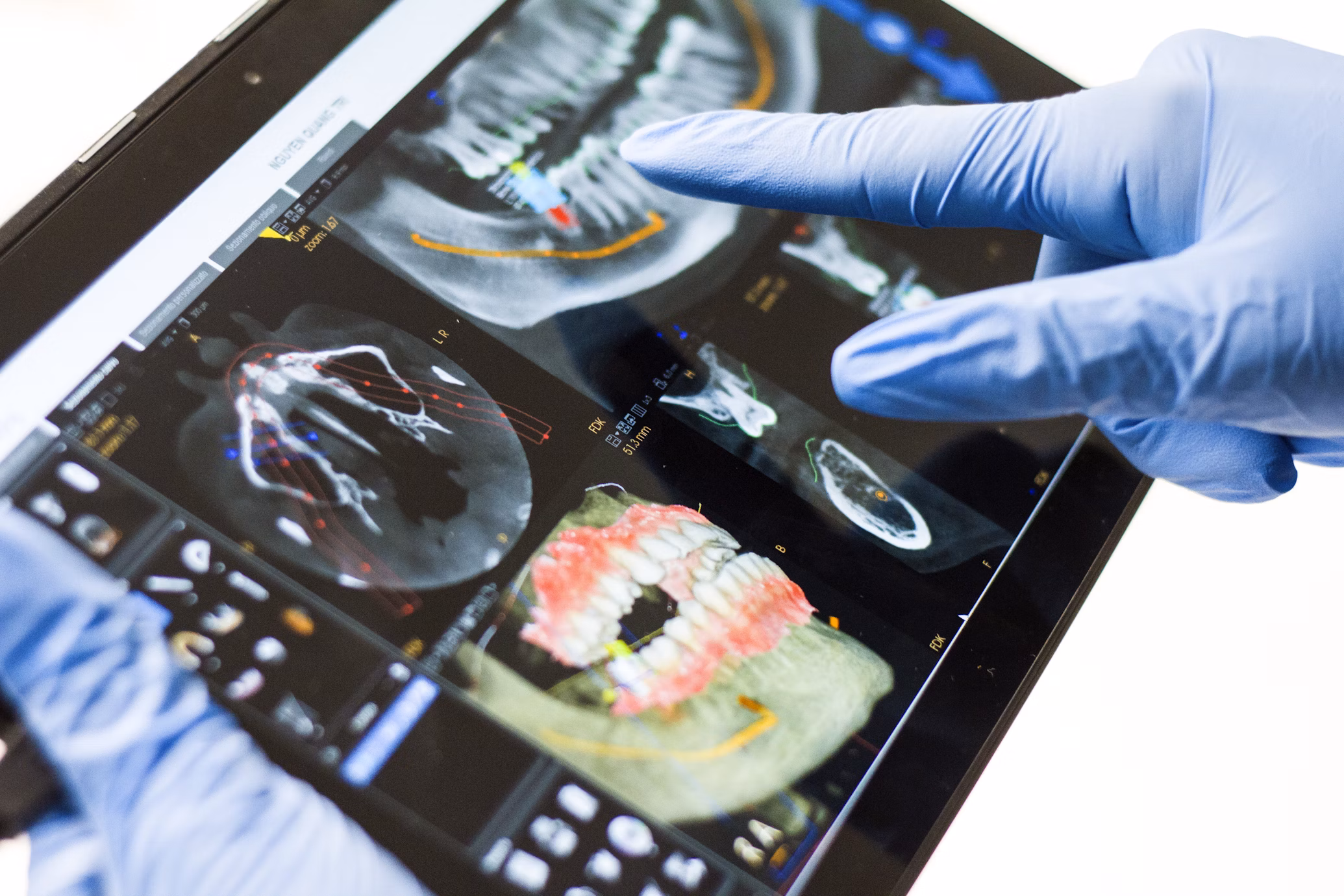 Dentist uses a tablet to view detailed dental X-ray images, highlighting oral health analysis. Gloved hand points for examination insights.