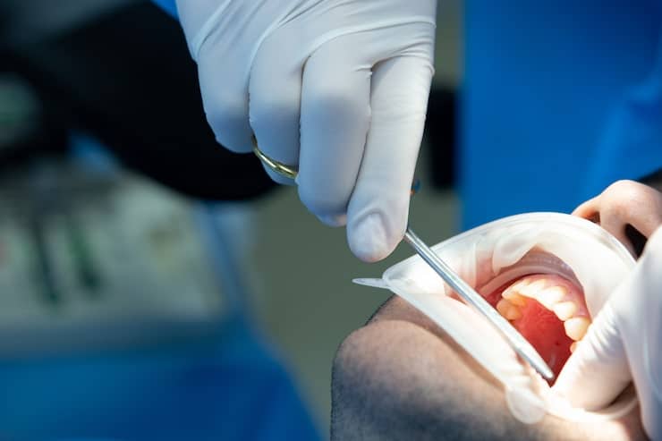 dentist with tool makes some manipulations patient s mouth 140725 7696