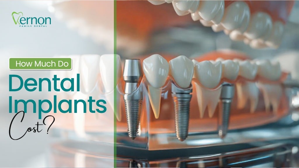 Dental Implants in North Oakville.
